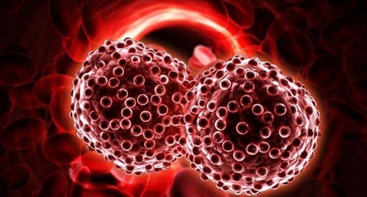 E’ possibile individuare la leucemia grazie ad un semplice test del sangue
