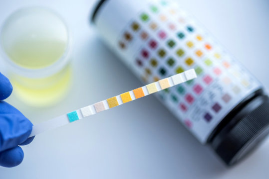 Un test delle urine, per sapere quanto velocemente stiamo invecchiando