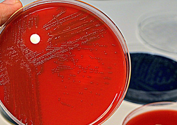 Setticemia: con il test rapido basta una goccia di sangue per diagnosticarla